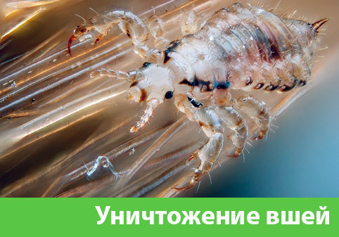 Уничтожение вшей в городе Коломна